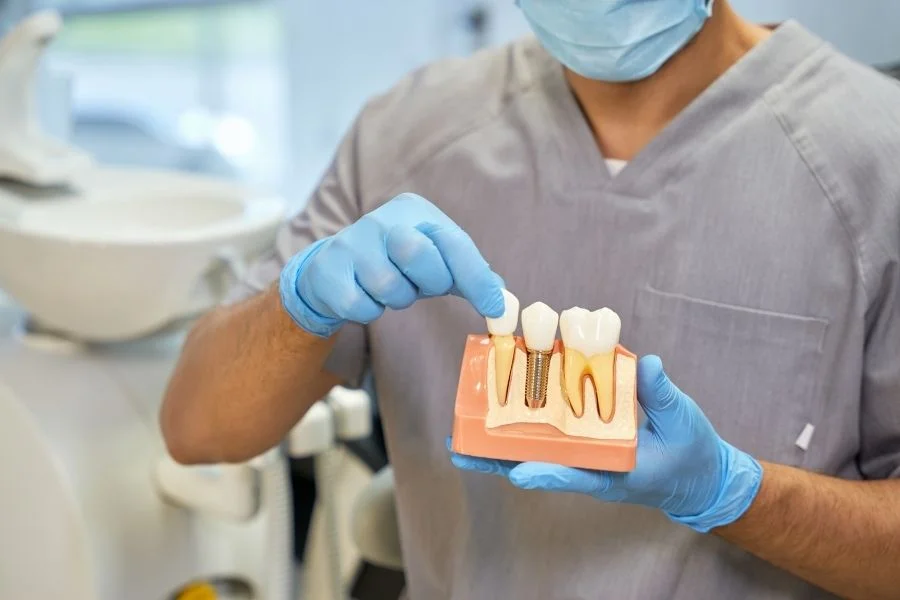 Dental Implants
