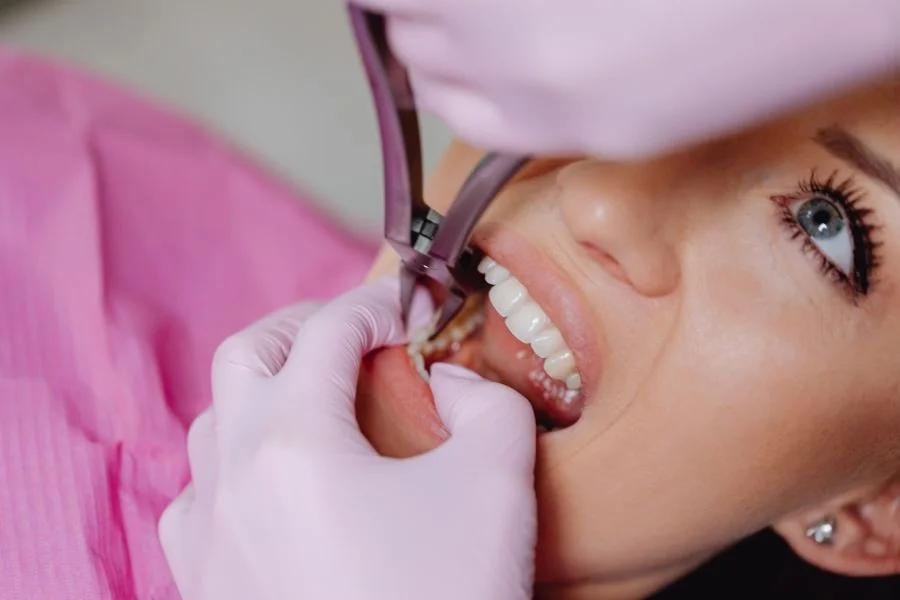Bad Breath Treatment