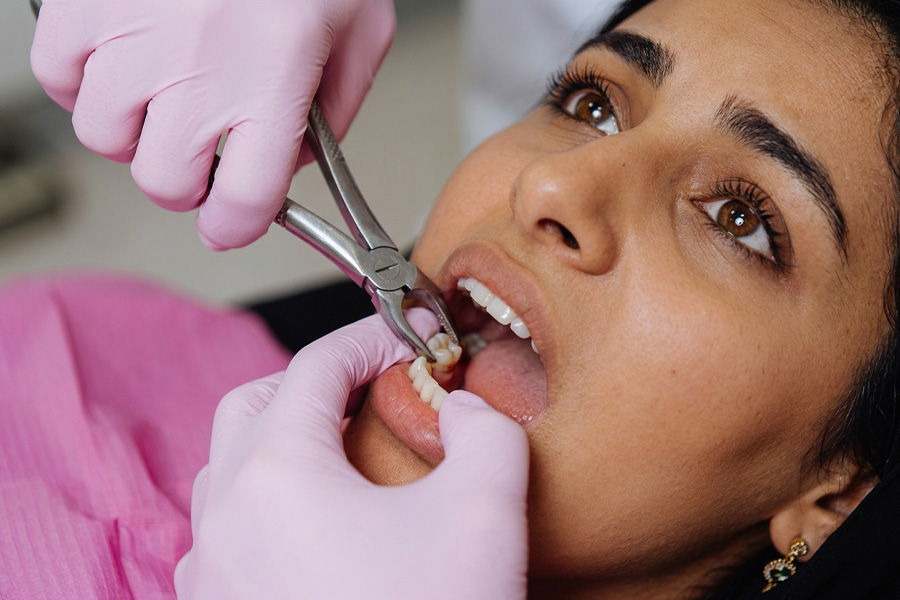 Cosmetic Fillings